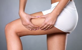 Cellulite Reduction Clearwater FL